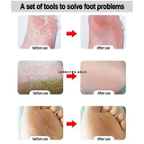 1 Pcs Professional Care Products Stainless Steel Callus Remover Foot File Scraper Pedicure Tools Dead Skin Remove for Heels Feet